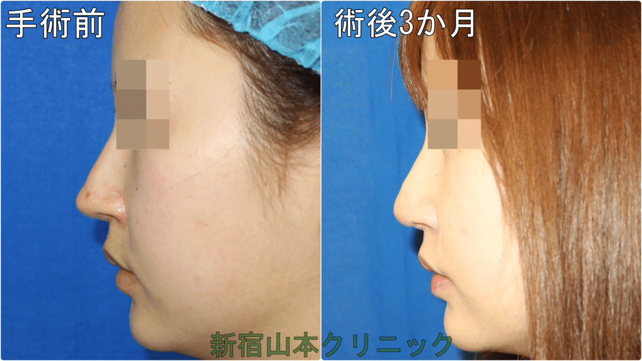 韓国整形のトラブル症例 新宿 山本クリニック Note