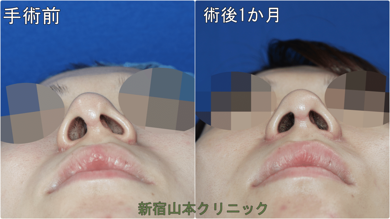 韓国整形のトラブル症例 新宿 山本クリニック Note