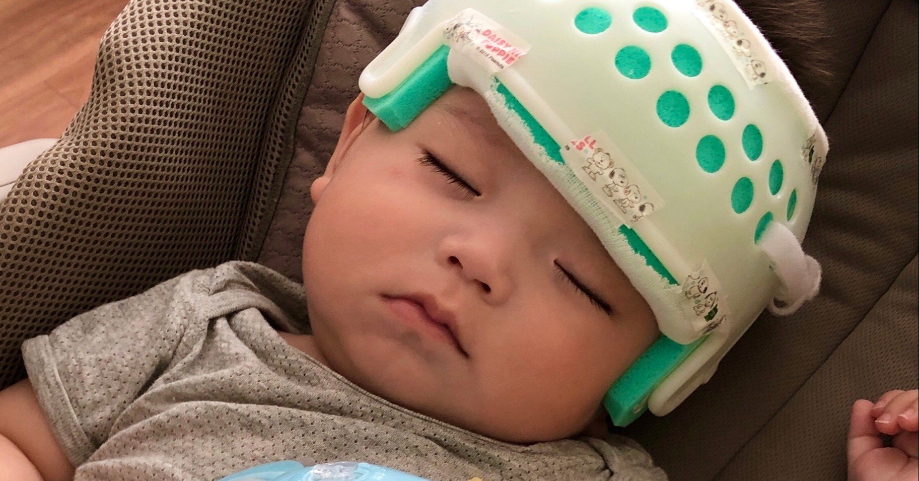 子どもの頭の形が気になる 専門家に相談するべきか 鑑定事例 Hirano Mao 花卜宙 Note