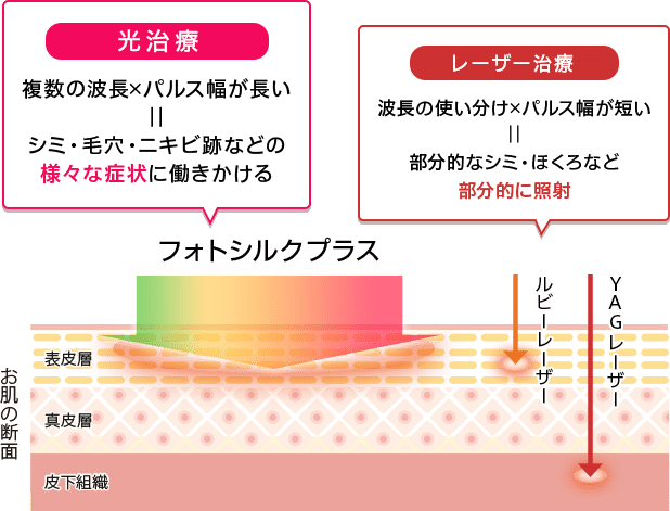 ありすぎて分かんない レーザー治療まとめ めが Note ありすぎて分かんない レーザー治療まとめ めが Note