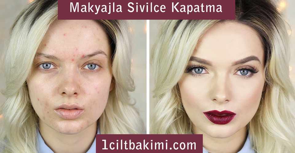 Makyajla Sivilceler Nasil Kapatilir Begonya Note