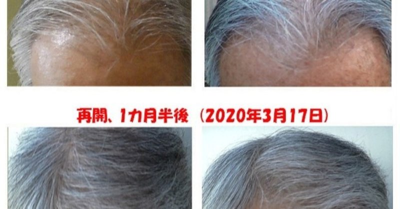 ハゲ薄毛 の新着タグ記事一覧 Note つくる つながる とどける ハゲ薄毛 の新着タグ記事一覧 Note つくる つながる とどける