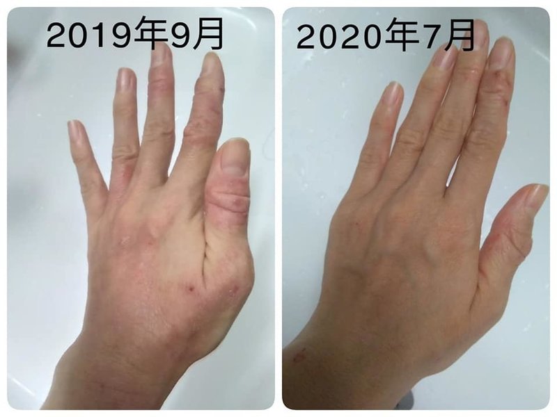 2019.9 →2020.7左手変化
