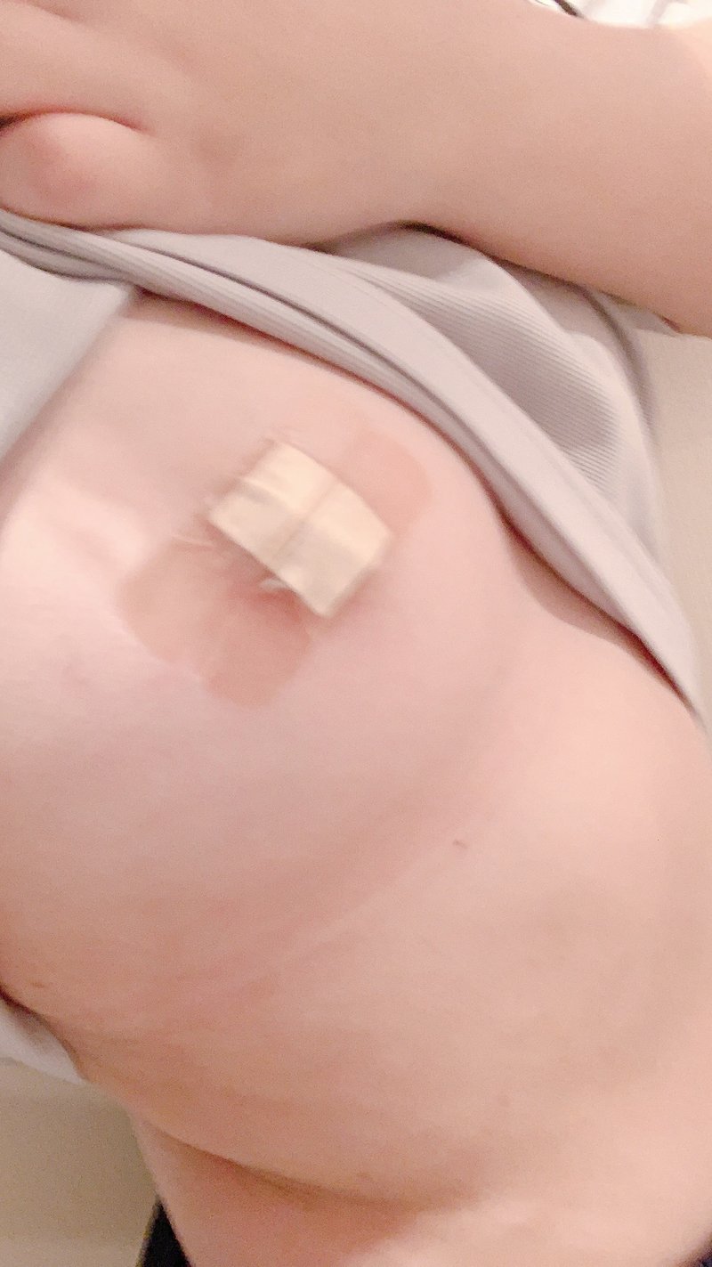 乳首 オロナイン