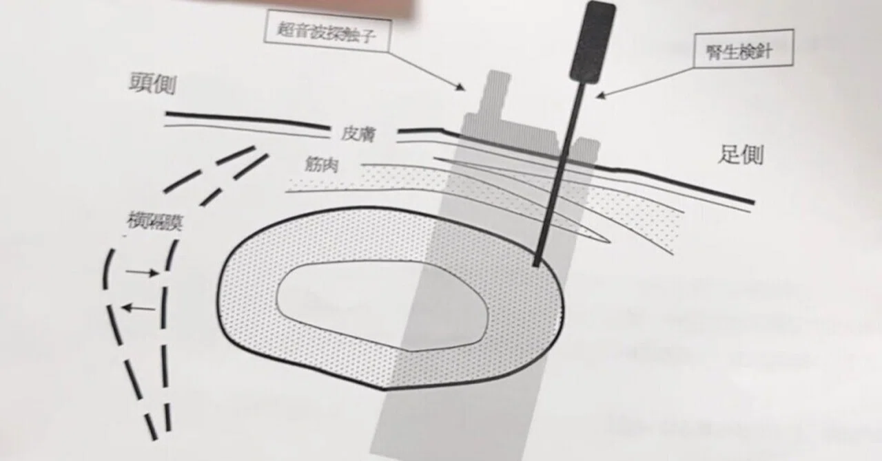 腎 生 検 体験 談