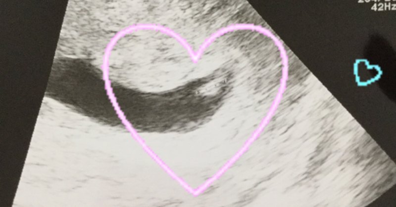 6w1d の新着タグ記事一覧 Note つくる つながる とどける