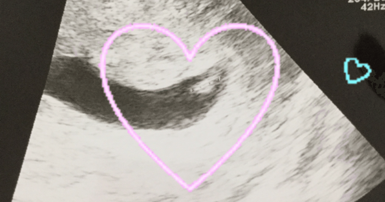 6w1d Et27フライング心拍確認 にこ天使ママ Note