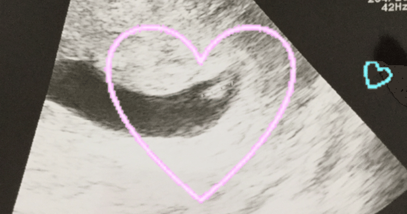 6w1d Et27フライング心拍確認 にこ天使ママ Note