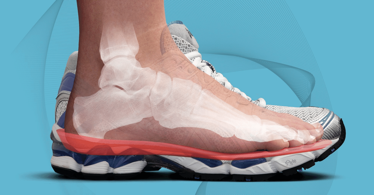 Технология стелек ФОРМТОТИКС