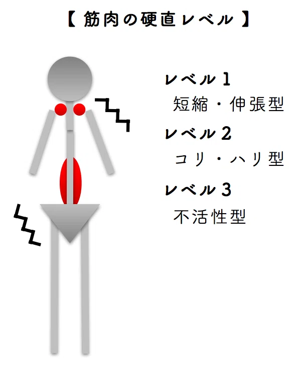 【体を柔らかくする基礎知識③】筋肉の硬直の仕方とは？｜リリースハウス
