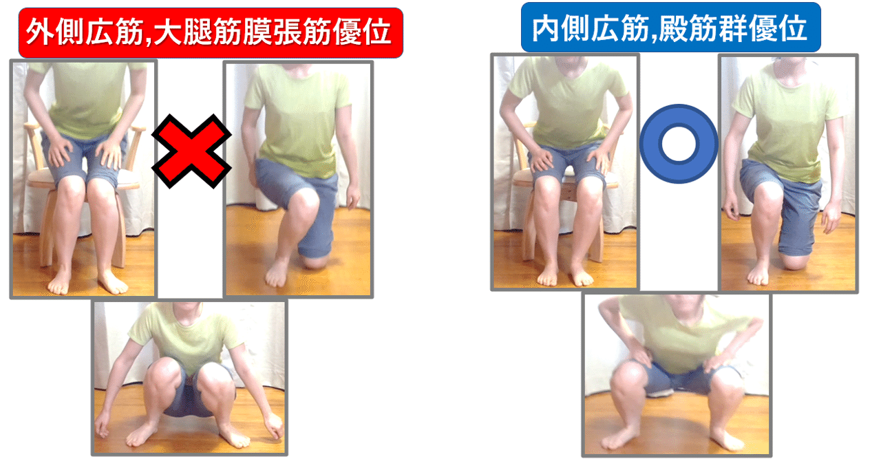 膝関節 第5回 《Knee in修正》｜上田浩司（理学療法士）