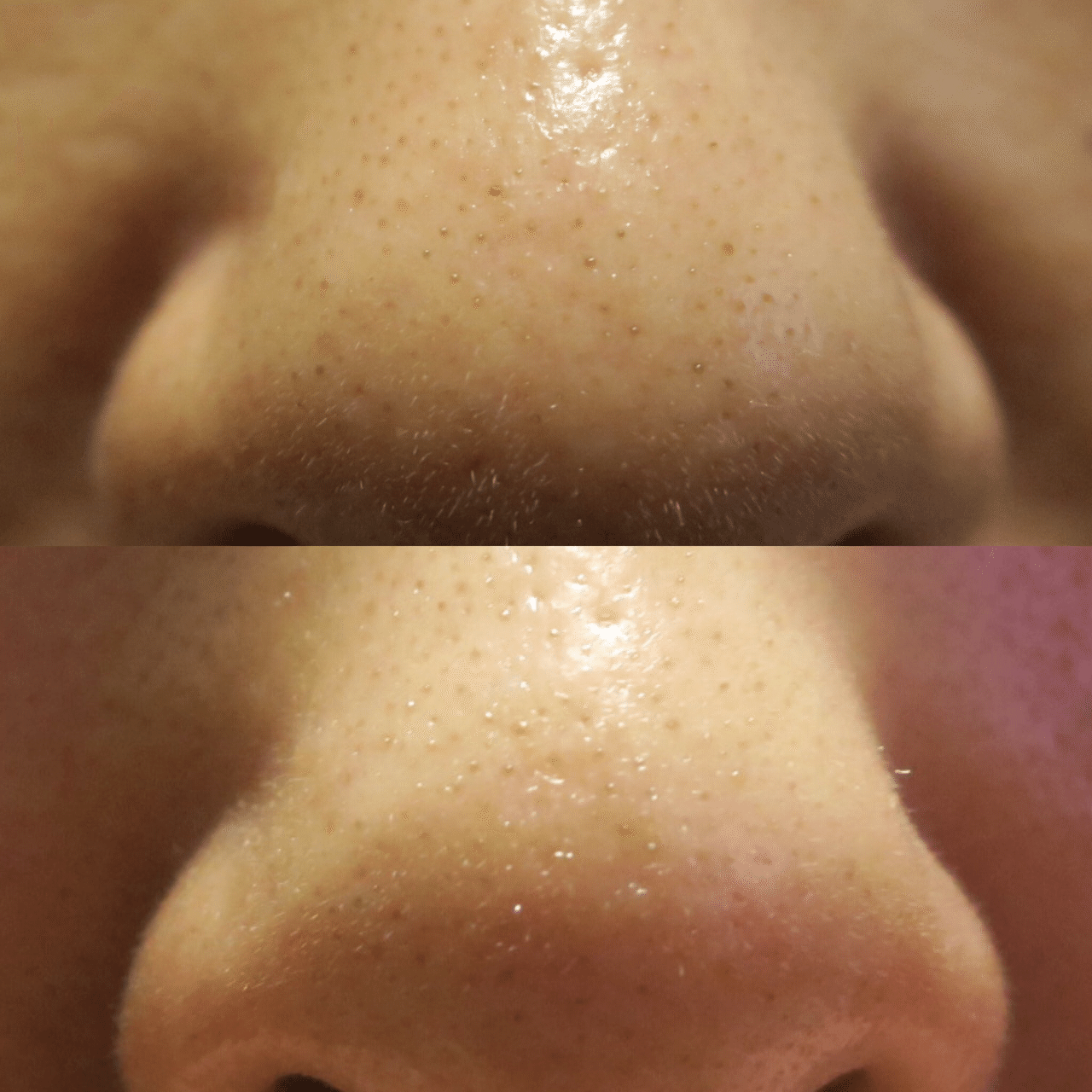 閲覧注意 ベビーオイル洗顔 美容ラボ Note