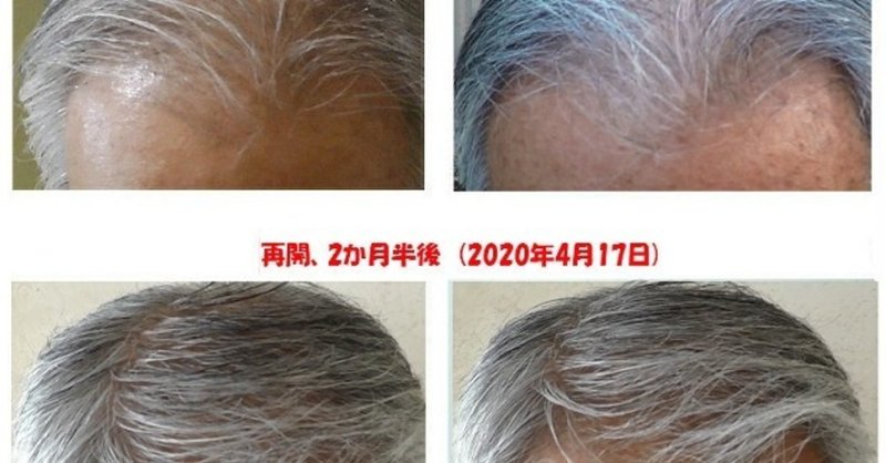 薄毛ハゲ の新着タグ記事一覧 Note つくる つながる とどける 薄毛ハゲ の新着タグ記事一覧 Note つくる つながる とどける