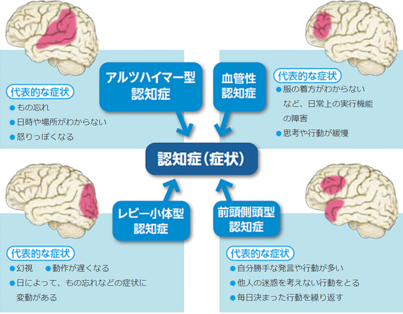 脳の異常部位２