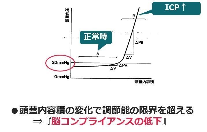 キャプccチャ