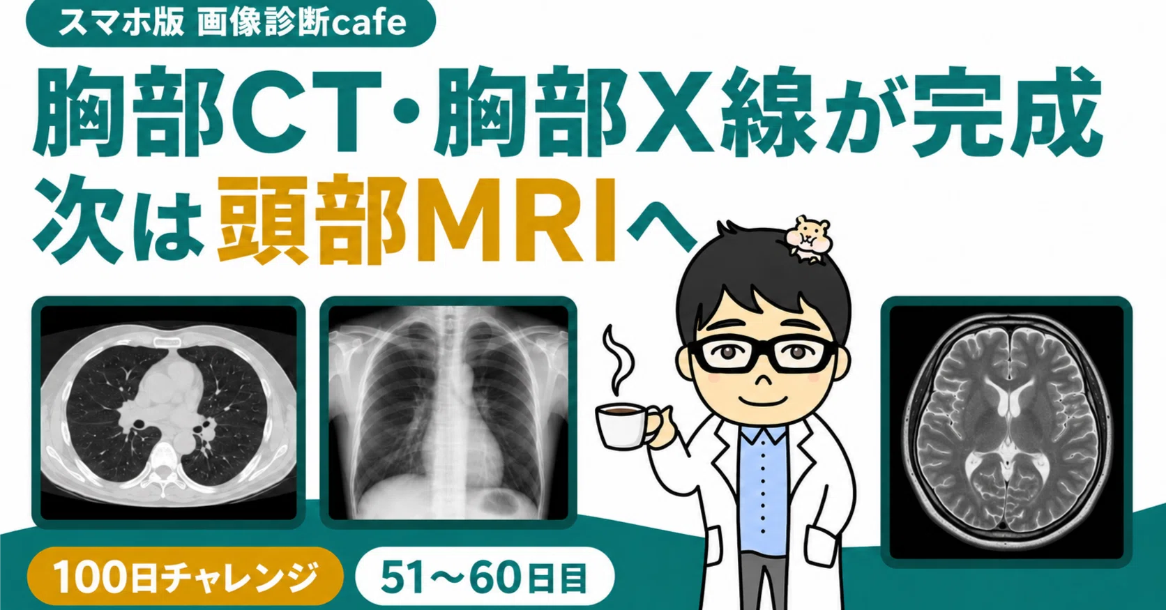 100日後に完成を目指すスマホ版画像診断cafe 51日目〜60日目まとめ