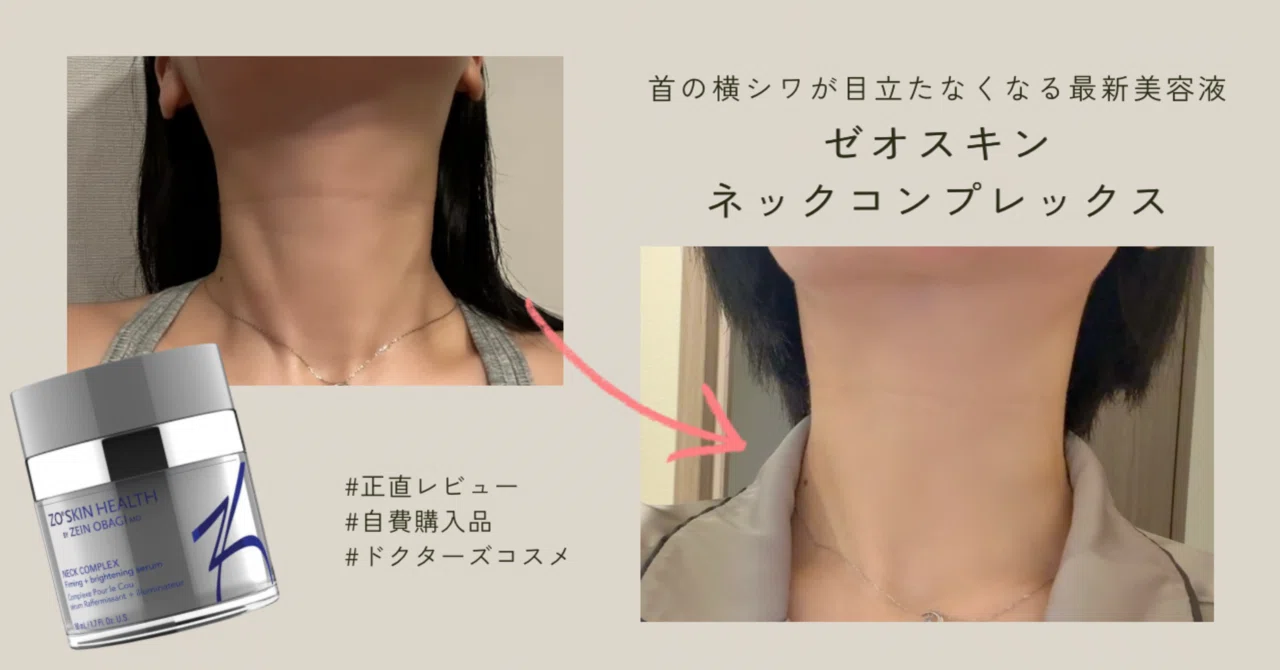 【セール】ゼオスキン　ネックコンプレックス　タルミ治療　首元クリーム 正直レビュー】ゼオスキン ネックコンプレックス ｜lune1013