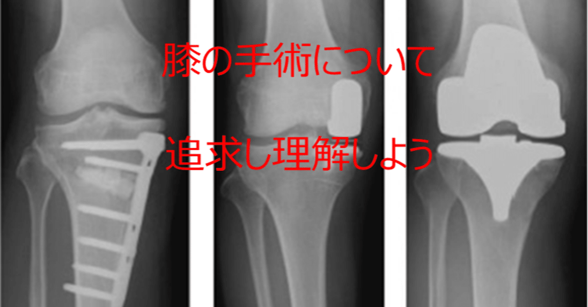 膝の手術を追求する（HTO/TKA/UKA）｜タカボーラボ