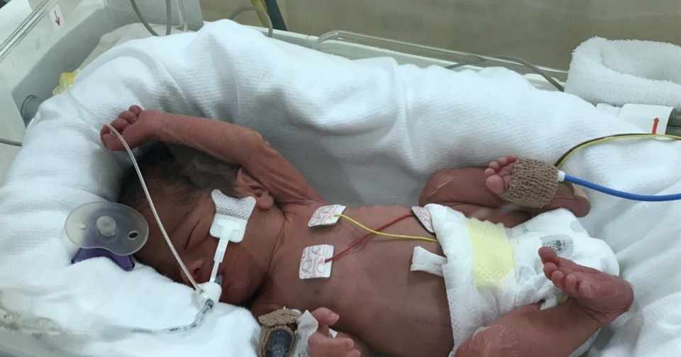 緊急帝王切開で1400gの子どもを産んだ話 青色 Note