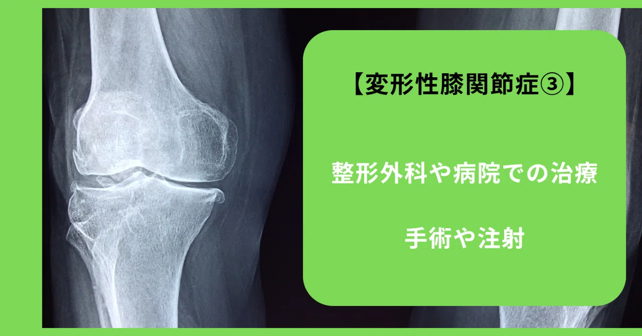 変形性膝関節症／完全解説その③】整形外科や病院での治療｜安行もり