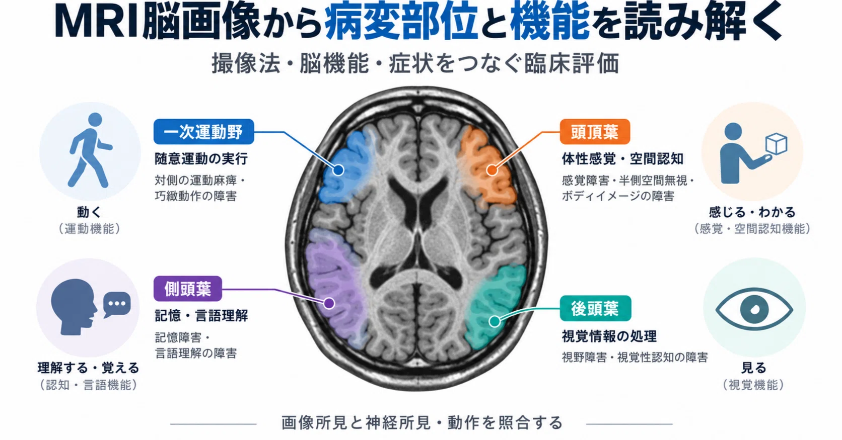 MRI脳画像から病変部位と機能を読み解く―撮像法・脳機能・症状をつなぐ