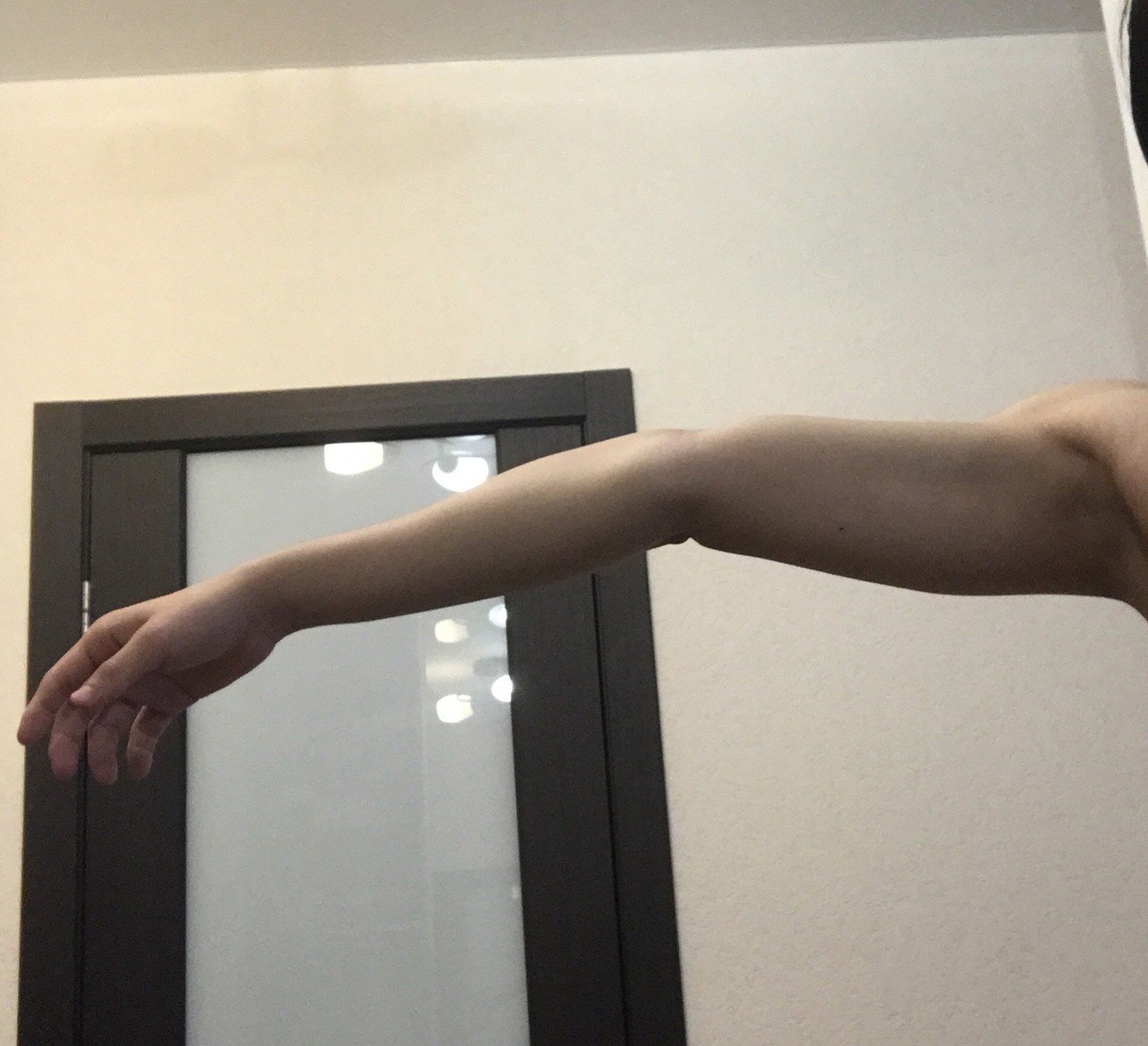 腕がぐにゃ んと反対に曲がる人いますか 細谷海斗 Note 腕がぐにゃ んと反対に曲がる人いますか 細谷海斗 Note