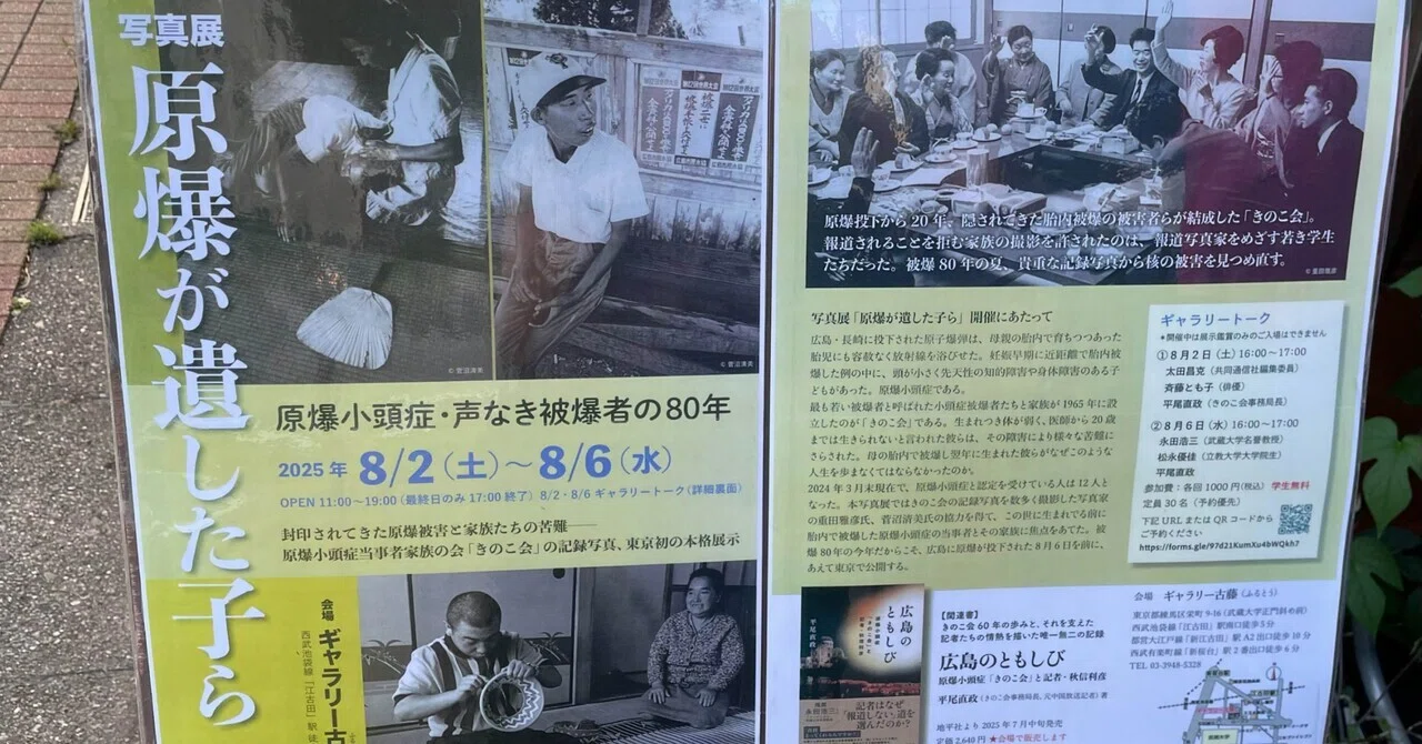 Love as 'Concealment': Microcephaly from the Atomic Bomb and Macro ...