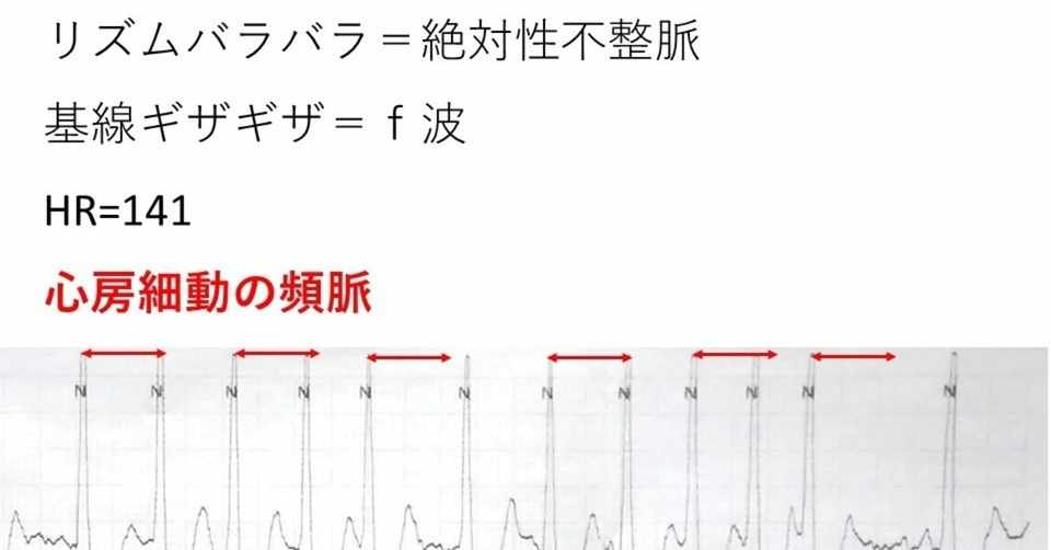 動画更新 今日の心電図vol 6 真鍋 Porcs代表 Note