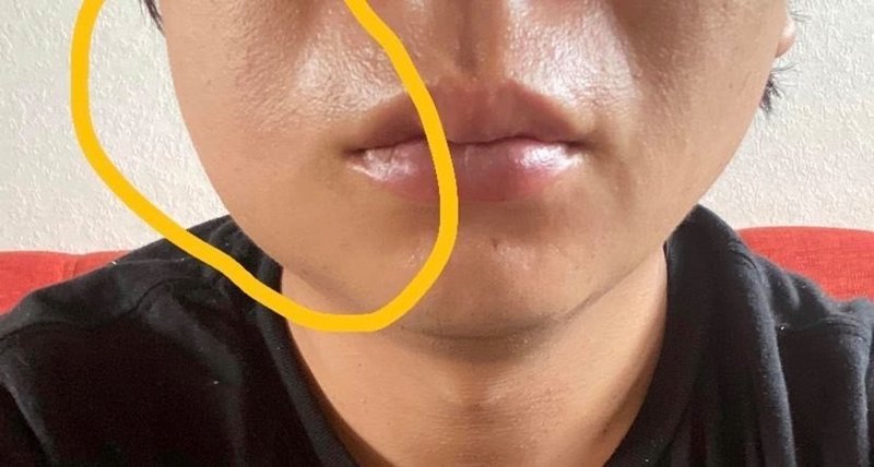 親知らず 抜く Philip D徳 Marlowe Note