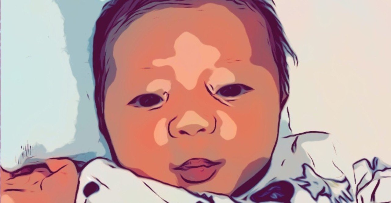 私と彼のこと 21 ウンナ母斑 中村章啓 Note