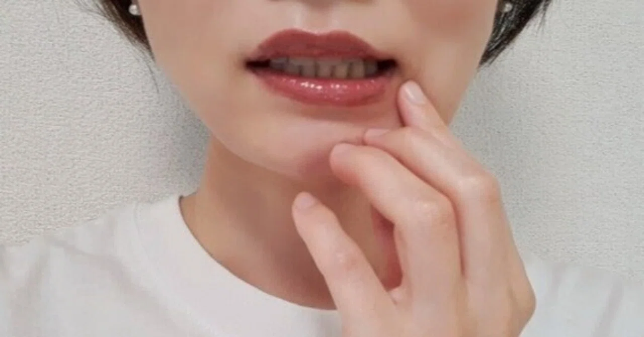 Can't Go Back to Dentures? Reasons Why Implants Are Chosen and Basic ...