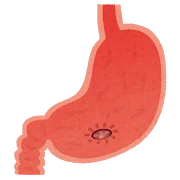 栄養食事療法№2 胃・十二指腸潰瘍 編…