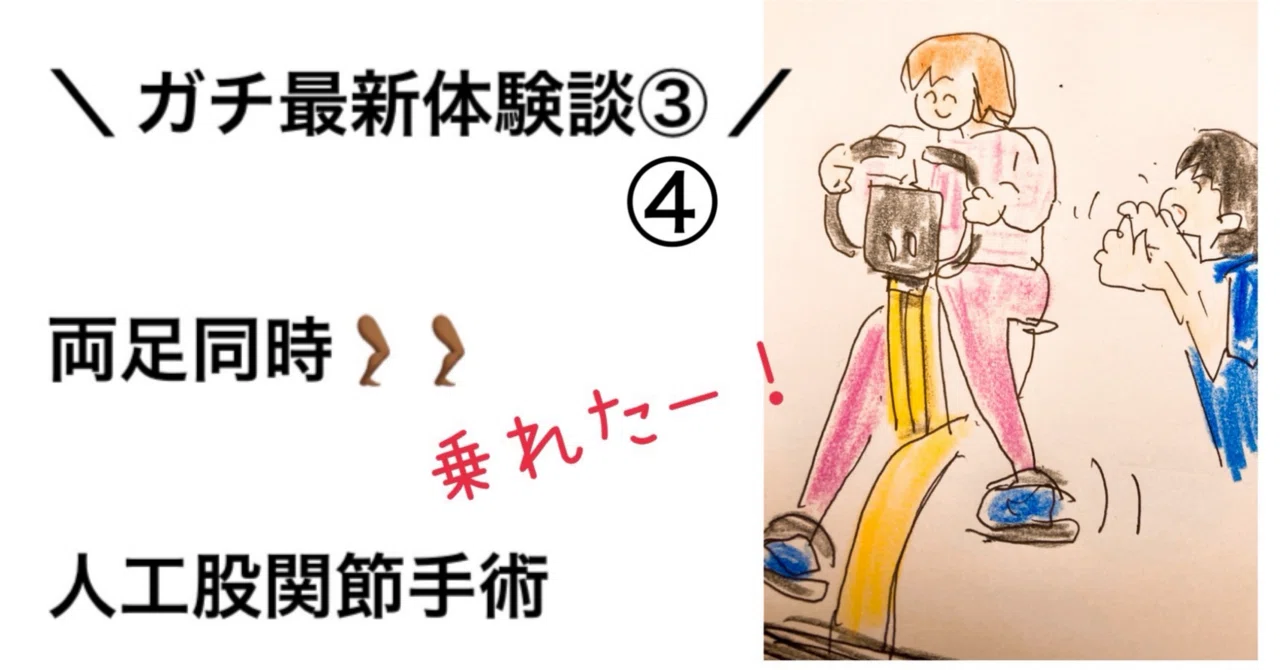 人工 股関節 両足 同時 手術
