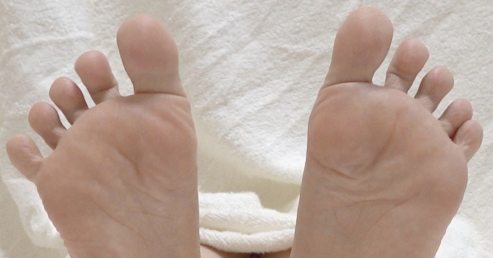 水虫 カサカサ水虫には薬よりも竹酢液 体の悩み子 Note