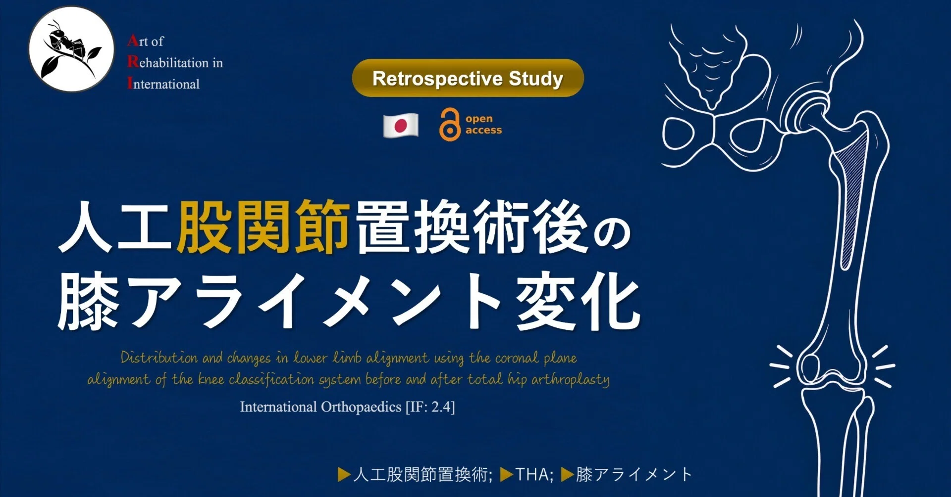 人工股関節置換術後の膝アライメント変化｜Super Human | 理学療法士
