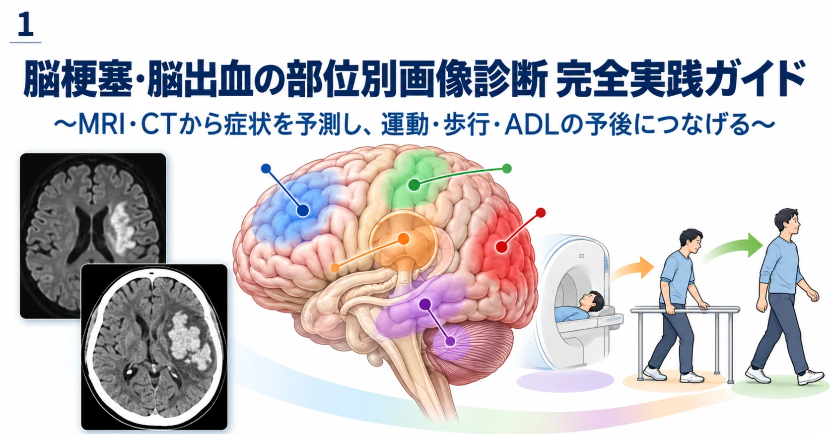 理学療法士のための脳梗塞・脳出血『画像評価』実践ガイド｜MRI・CT