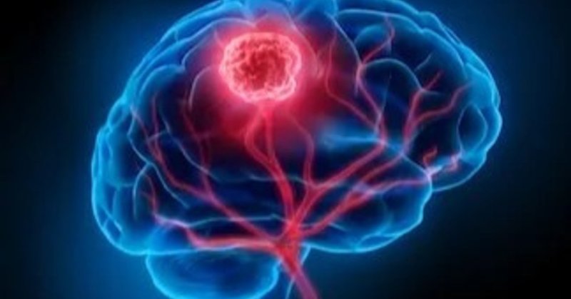 年を取っても記憶力がいい人と低下する人の差 たか理学療法士 みんながセラピストになれば多くの人が助けられる note