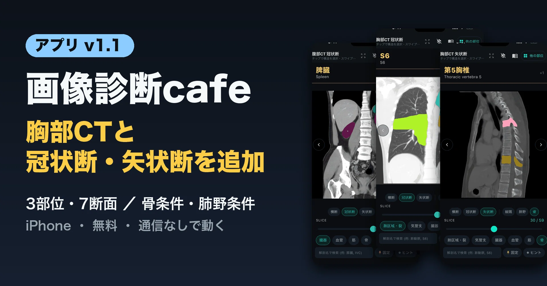 画像診断cafeアプリがv1.1に。胸部CTと、冠状断・矢状断が入りました
