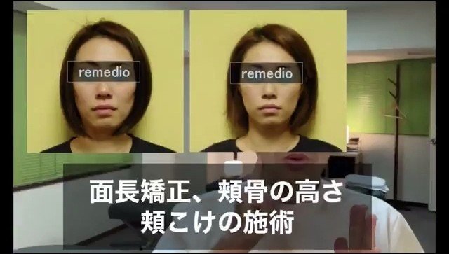 面長改善 目と口の間を短くする方法 お顔の整体師 戸塚哲春 Note