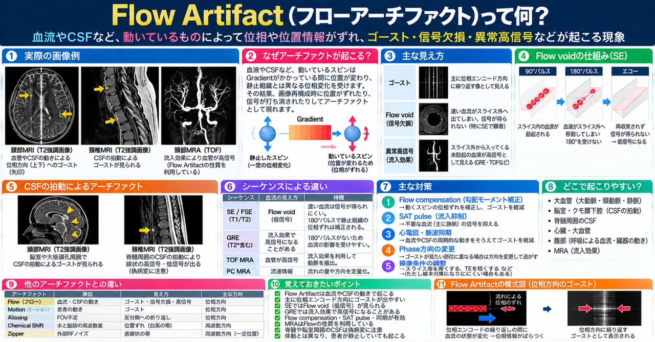 What is a Flow Artifact?｜ウマ好きの放射線講義