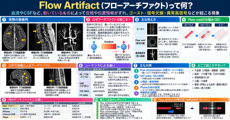 What is a Flow Artifact?｜ウマ好きの放射線講義