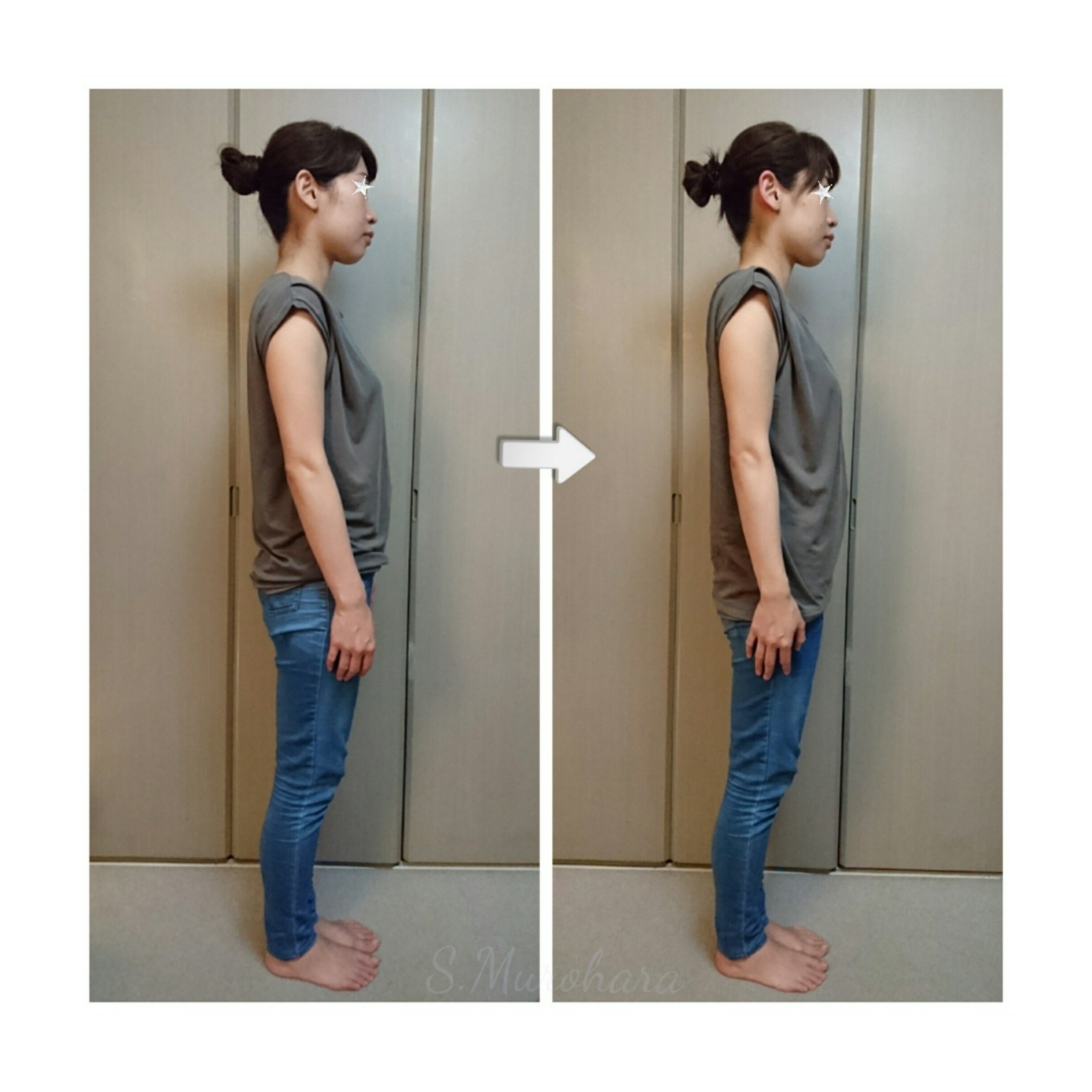 大胸筋をやわらかくゆるめることとても大事 の新着タグ記事一覧 Note つくる つながる とどける