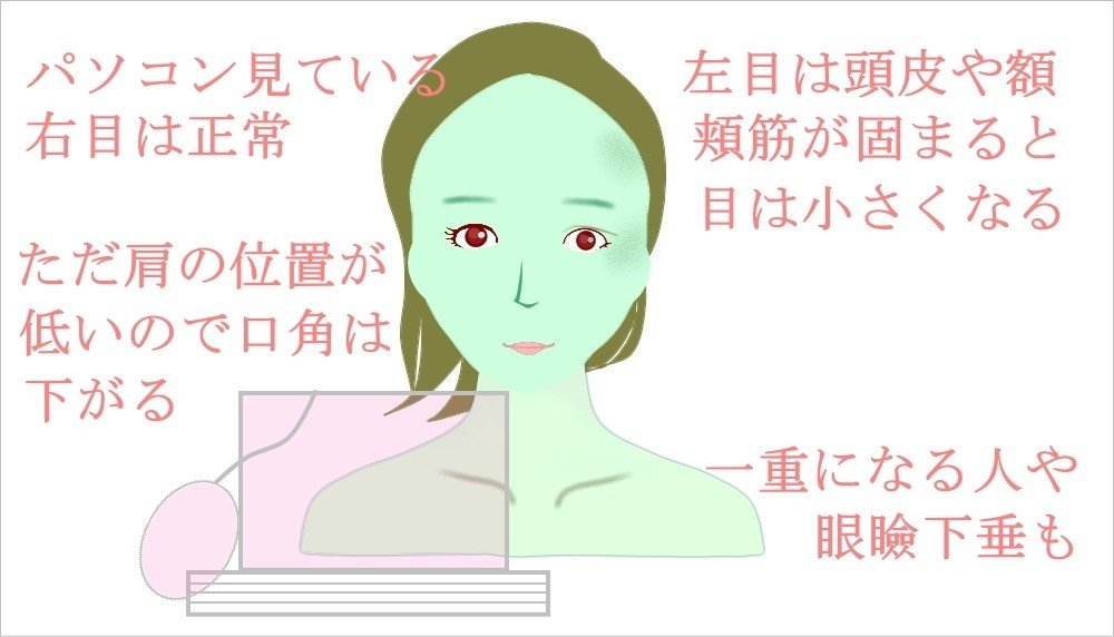 片目が小さい なおす方法 お顔の整体師 戸塚哲春 Note 片目が小さい なおす方法 お顔の整体師 戸塚哲春 Note