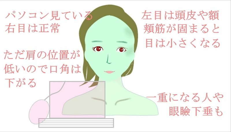 片目が小さい なおす方法 お顔の整体師 戸塚哲春 Note