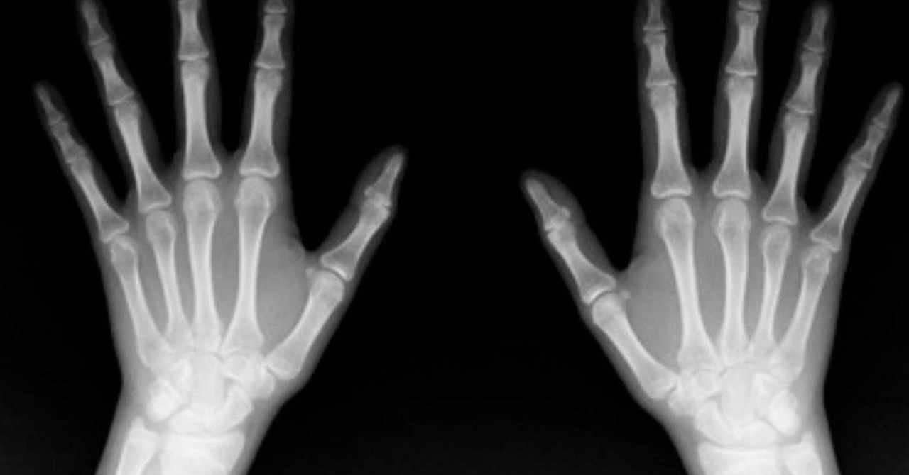 レントゲン写真 の新着タグ記事一覧 Note つくる つながる とどける