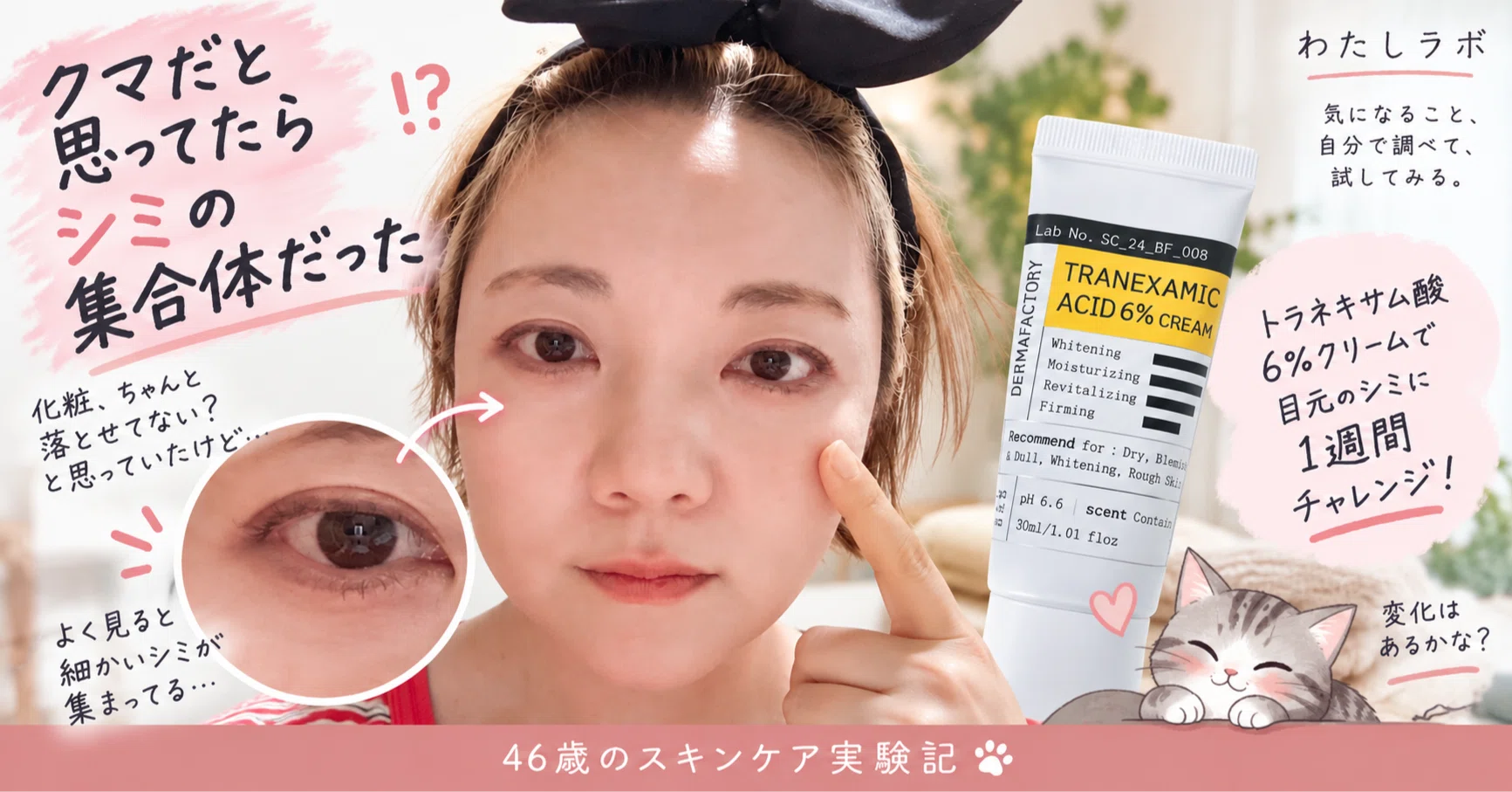 😱クマだと思ってたらシミの集合体だった。トラネキサム酸6％を1週間