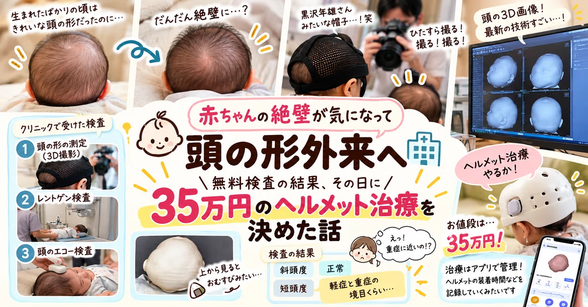 Rectangle Shape Types I was worried about my baby's flat head, so I went to a head shape ...