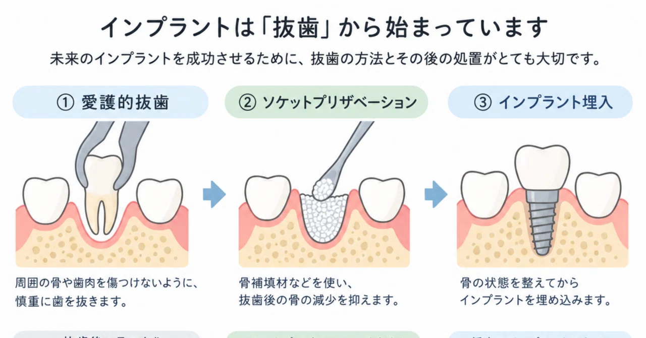 Does Implant Treatment Begin with Tooth Extraction? 