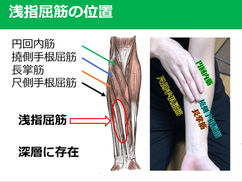 浅指屈筋が肘外反ストレスのスタビライザーとなる Y K Note