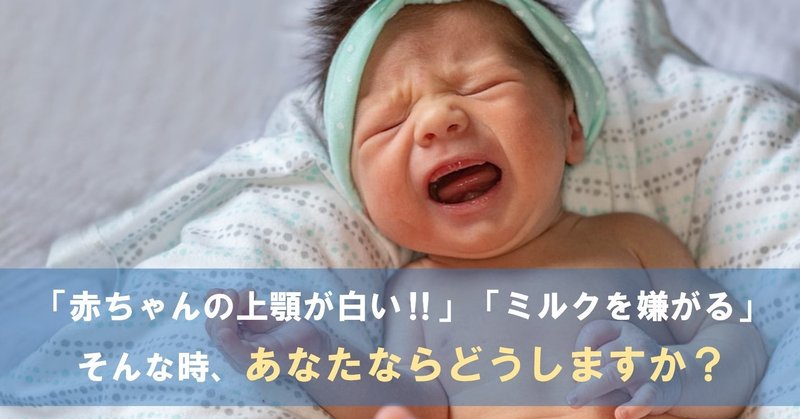 歯科医師が教える 赤ちゃんの上顎が白い 今すぐ知っておくと安心な べドナーアフタ の話 歯科医師やまて Note
